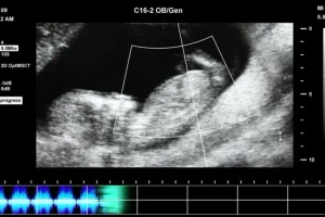 抖音快手无人直播胎教助眠全攻略：教程+软件+素材